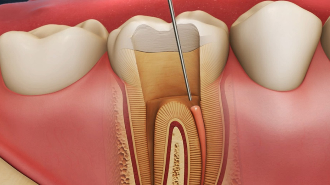 Dentalia smiles